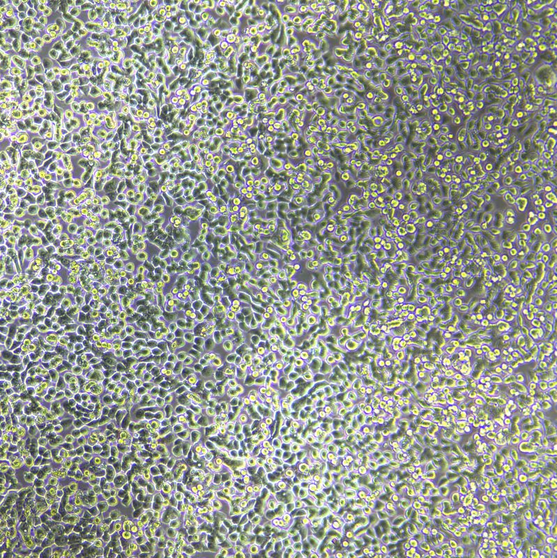 NCI-H2122人非小細(xì)胞肺癌細(xì)胞