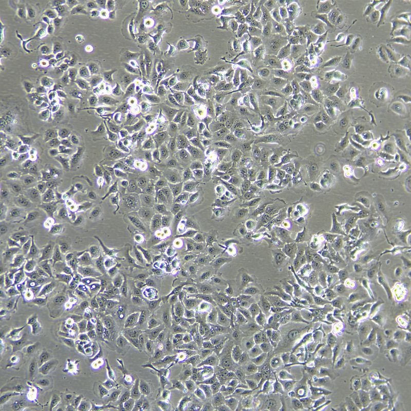 KYSE150 人食管癌細(xì)胞