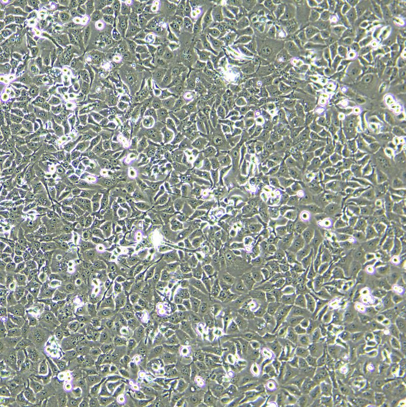 KYSE150 人食管癌細(xì)胞