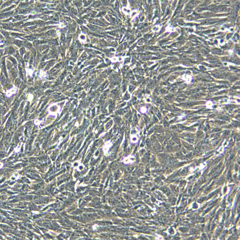CT2A-EGFP-LUC 小鼠膠質(zhì)瘤細胞系轉(zhuǎn)染熒光素酶-增強型綠色熒光蛋白細胞